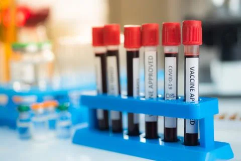 Blood sample with vaccine in test tube for COVID-19 analyzing. Stock Photos