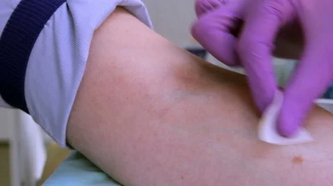 Blood sample from a vein closeup Stock Footage 42885606