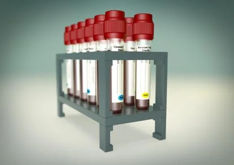 Blood sample viles in a multiple holder stand Stock Photos