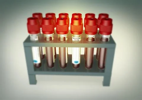 Blood sample viles in a multiple holder stand Stock Photos