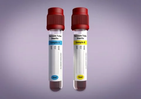 Blood sample viles Stock Photos