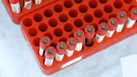 Blood samples in containers. Top panoramic view Video stock 103140474