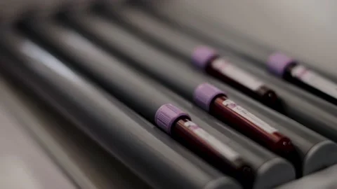 Blood samples Stockbeeldmateriaal 130693499