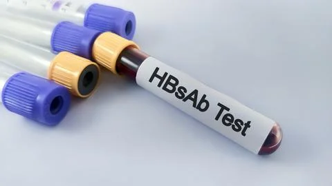 Blood samples isolated on white background for HBsAb test. Foto stock