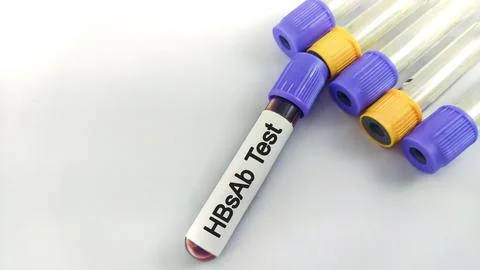 Blood samples isolated on white background for HBsAb test. Stock Photos