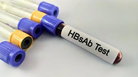 Blood samples isolated on white background for HBsAb test. Stock Photos