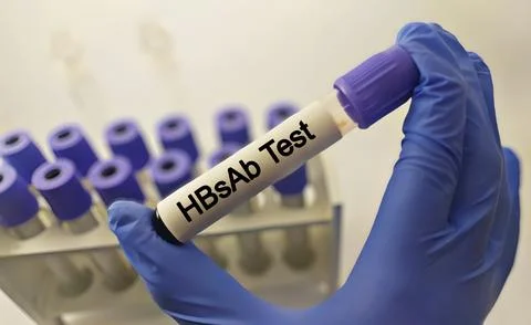 Blood samples isolated on white background for HBsAb test. Stock Photos