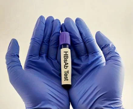 Blood samples isolated on white background for HBsAb test. Stock Photos