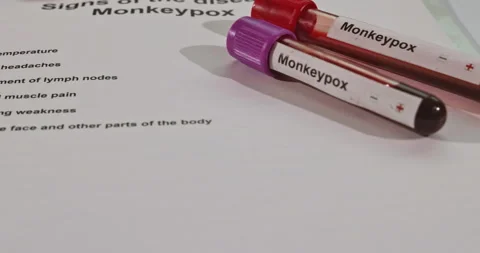 Blood samples labeled for monkeypox testing along with medical paperwork on a Stock Footage 305569247