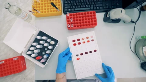 Blood samples on a special tray, top view. A nurse checks blood samples on a Stock Footage 91138430