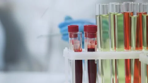 Blood samples standing on the table, HIV test, microbiological specimens 스톡 사진