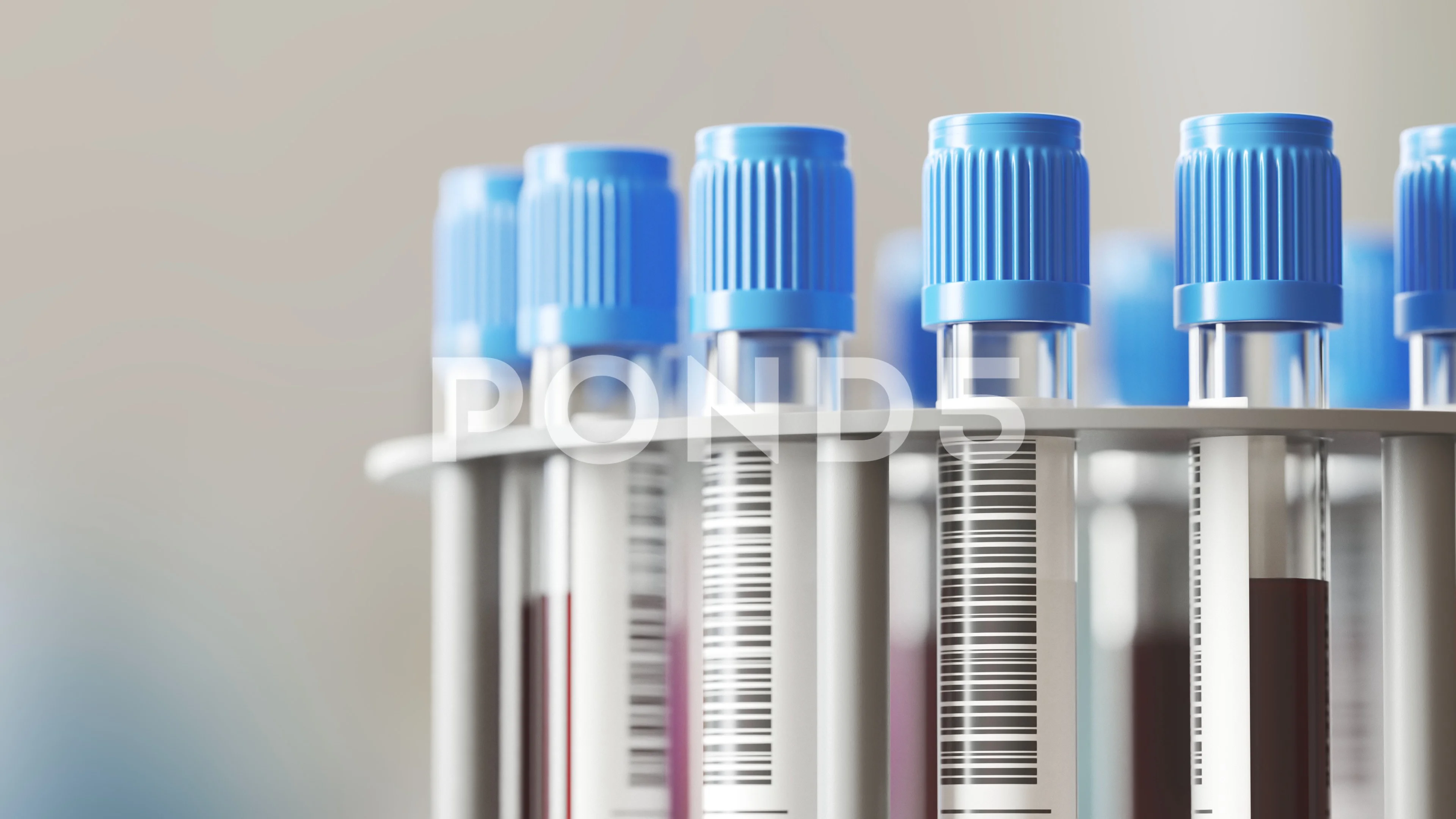 Video Blood Samples In A Test Tube Centrifuge Bunch Of Tubes In