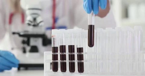 Blood samples in test tubes in a medical laboratory Stock Footage 287496962