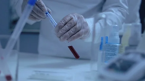 Blood Samples In A Test-Tubes ready for Centrifuge Stock Footage 128991040