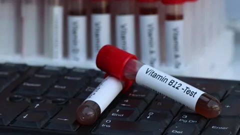 Blood samples for testing vitamin B12 in the laboratory Video stock 221458786