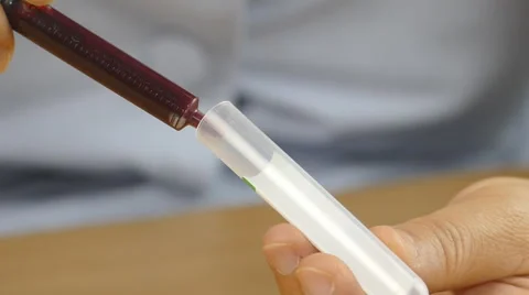 Blood samples into tube. Stock Footage 61211343