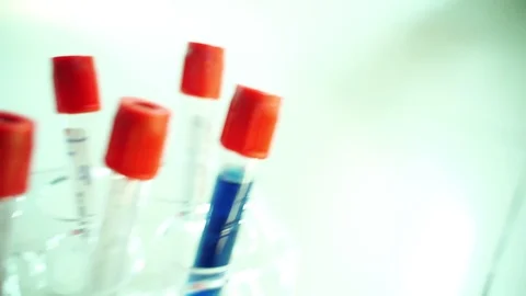 Blood samples tubes test in the doctor's office.To detect  Coronavirus,Covid-19 動画素材 127627508
