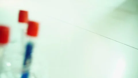 Blood samples tubes test in the doctor's office.To detect  Coronavirus,Covid-19 Vídeos de archivo 127627522