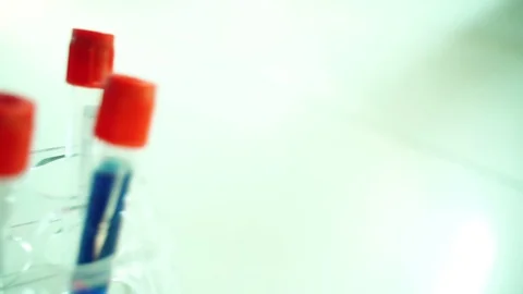 Blood samples tubes test in the doctor's office.To detect  Coronavirus,Covid-19  動画素材 127627551