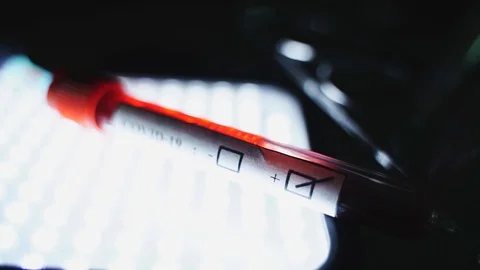 Blood samples tubes test in the doctor's office.To detect  Coronavirus,Covid-19 動画素材 127695017