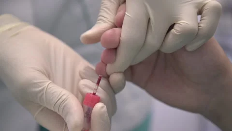 Blood sampling for analysis. Stock Footage 166001242