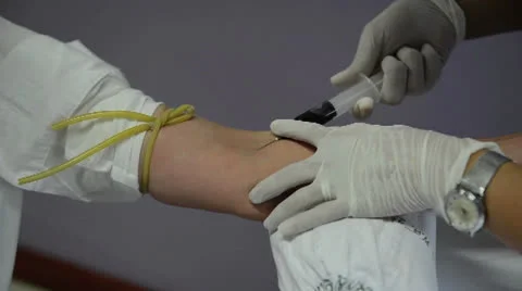 Blood sampling extraction from vein using needle by the professional Stock Footage 26322614