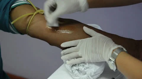 Blood sampling extraction from vein using needle by the professional Video stock 26323033