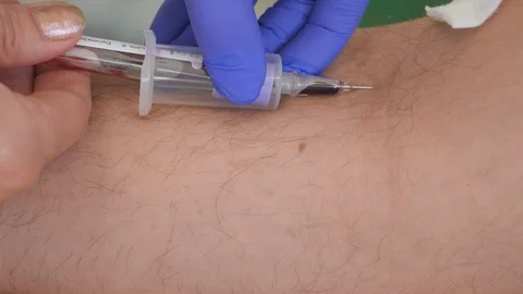 Blood sampling at a medical facility. Stock Footage 106089217