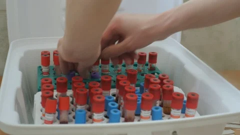 Blood sampling at a medical facility. Stock Footage 106259016