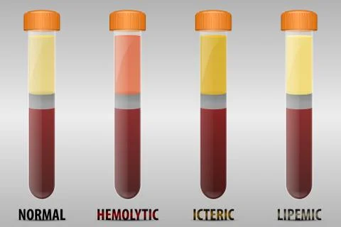 Blood serum common types Stock Illustration