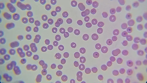 Blood smear under the microscope Stock Footage 120950560