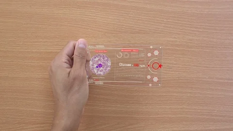Blood sugar testing (Glucose High level) your self at home Stock Footage 101629366