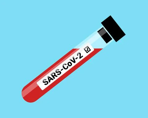 Blood test and taking of sample - blood in the container is positive for coro Stock Illustration