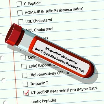 Blood Test Checklist and Sample Tube Stock Illustration