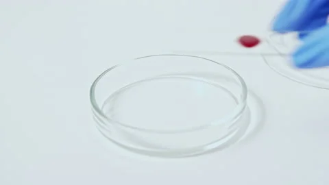 Blood test clinical diagnostics red sample set 2 Stock Footage 135029102