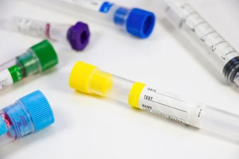 Blood test empty tubes samples on the white background, studio shoot. Stock Photos