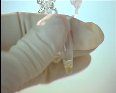 Blood Test Stock Footage 1066850