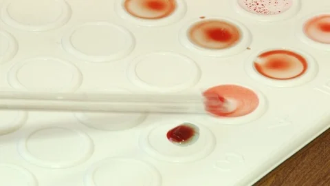 Blood test Stock Footage 103188627