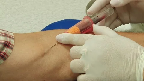 Blood test Stock Footage 130793705