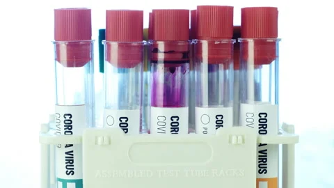 Blood test 動画素材 133544931