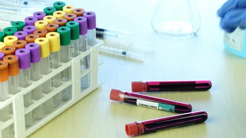 Blood test Stock-Footage 133545455