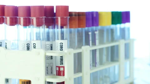 Blood test Stock-Footage 133545783