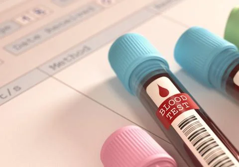 Blood Test Stock Illustration