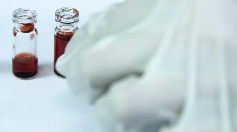 Blood test in laboratory Stock Footage 10584231