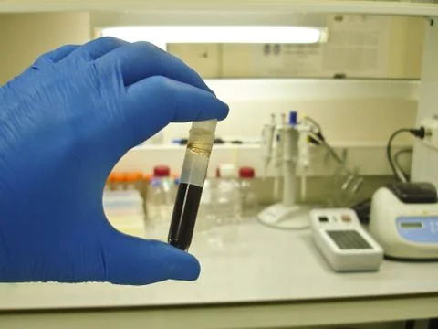 Blood test in the laboratory. Stock Photos