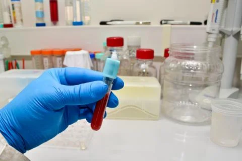 Blood test in the laboratory. Stock Photos