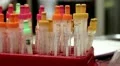 Blood test in medical laboratory HD Footage