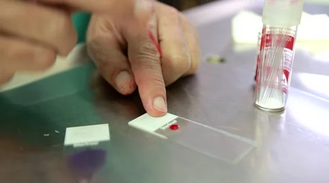 Blood test for pet Vídeos de archivo 62847133