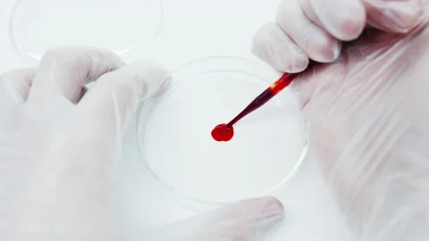 Blood test in petri dish.  Stock Footage 149175282