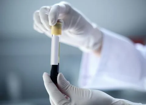 Blood test Stock Photos